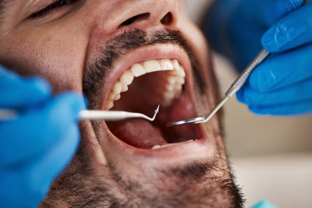 Best Emergency Dentist for Knocked-Out Tooth in Gretna, FL